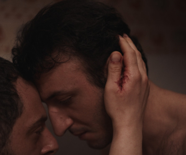 Photo: Skin of Sadness